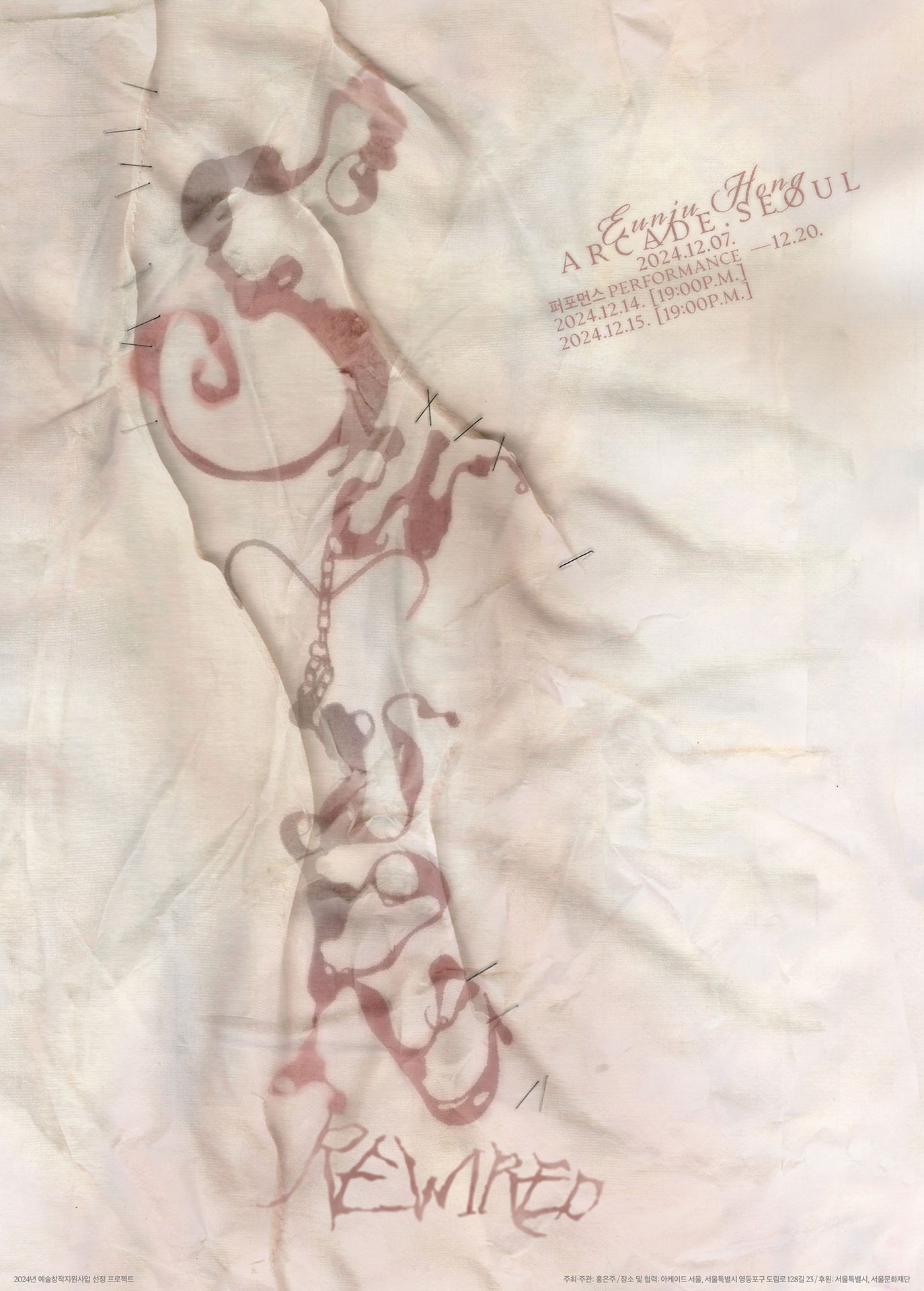 Suture-rewired